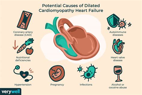 dilated cardiomyopathy signs and symptoms